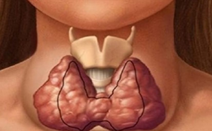 щитовидная железа узлы размеры норма